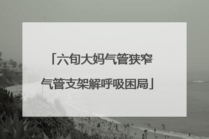 六旬大妈气管狭窄 气管支架解呼吸困局